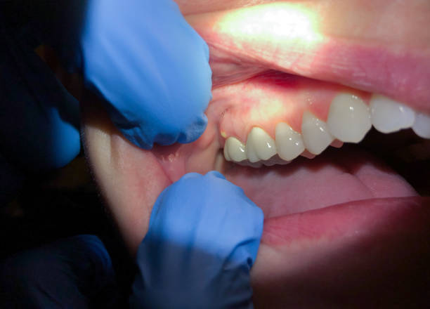 Best Emergency Dental Services for Seniors in Bristol, VA